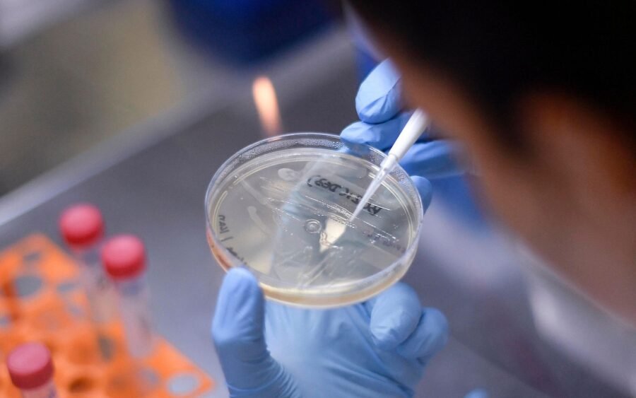 La possibile correlazione tra il vaccino per tubercolosi (BCG) e coronavirus 5 a1868e22c98d7eb83b408104d6076f3b9d5783bd risultato